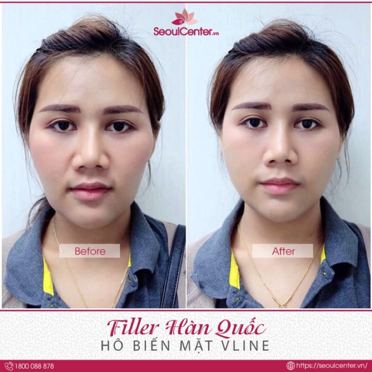 Thẩm mỹ viện Seoul Center