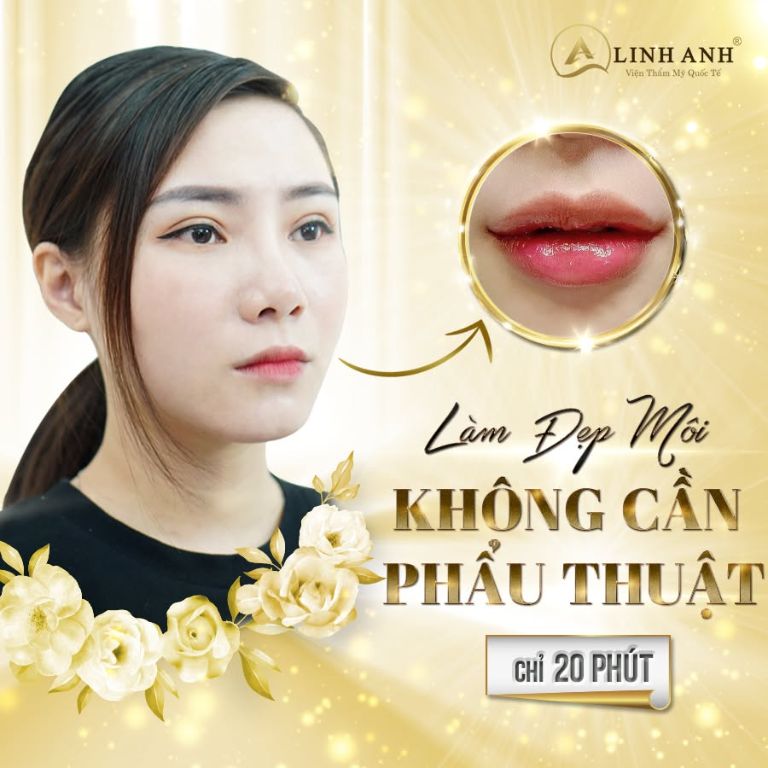 Thẩm mỹ viện Quốc tế Linh Anh