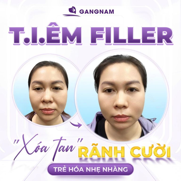 Thẩm mỹ Gangnam