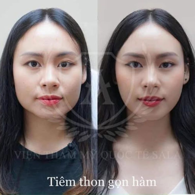 Viện thẩm mỹ Quốc tế SALA