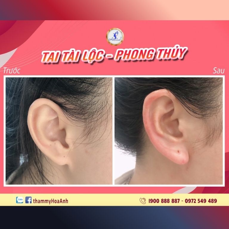 Viện thẩm mỹ Hòa Anh