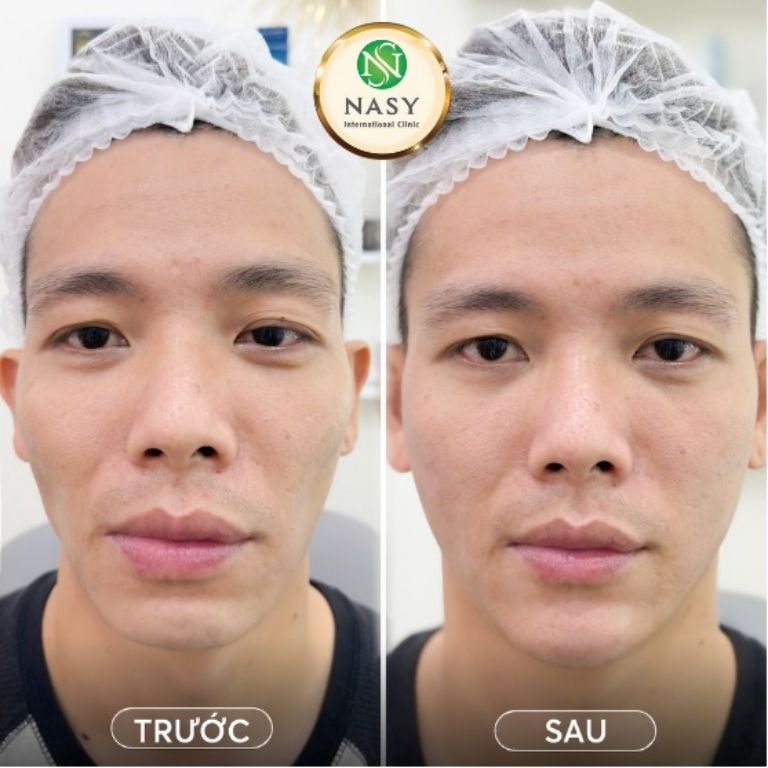 hẩm mỹ Thủy Tiên Nasy