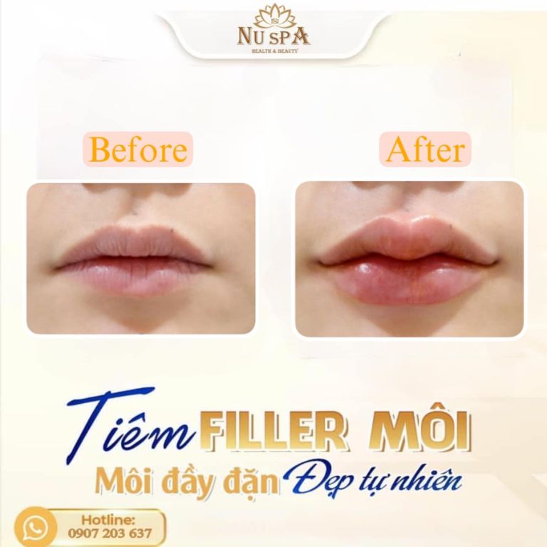 NU Spa Health & Beauty