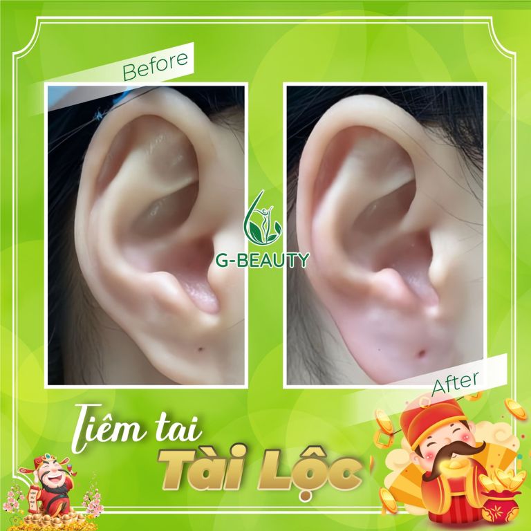 Viện thẩm mỹ G-Beauty