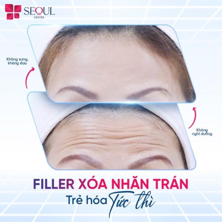 Thẩm mỹ viện Seoul Center 