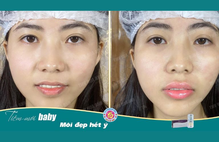 Thẩm mỹ viện Hoa Anh