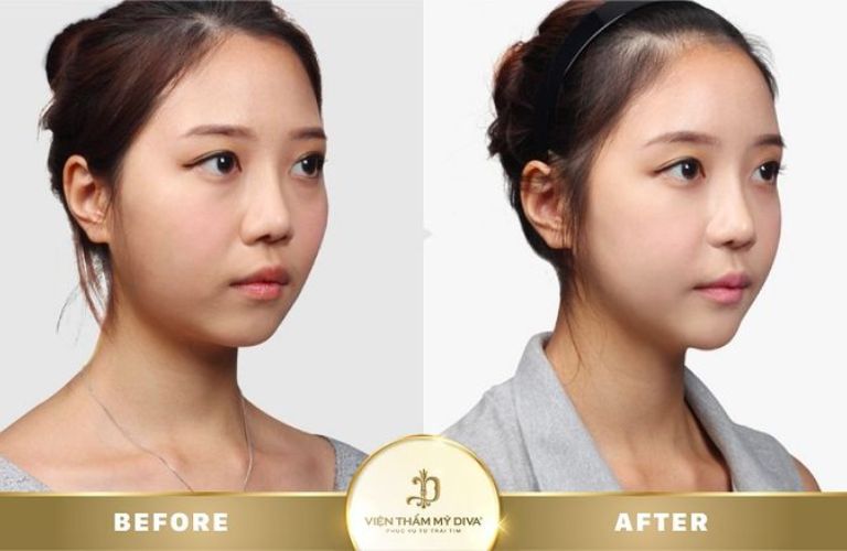 Viện Thẩm Mỹ DIVA