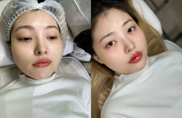 Thẩm Mỹ - Mỹ Ngọc Beauty & Clinic Center