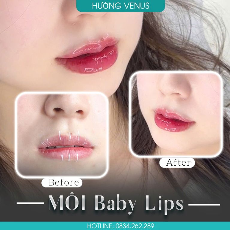 Thẩm mỹ viện Hường Venus