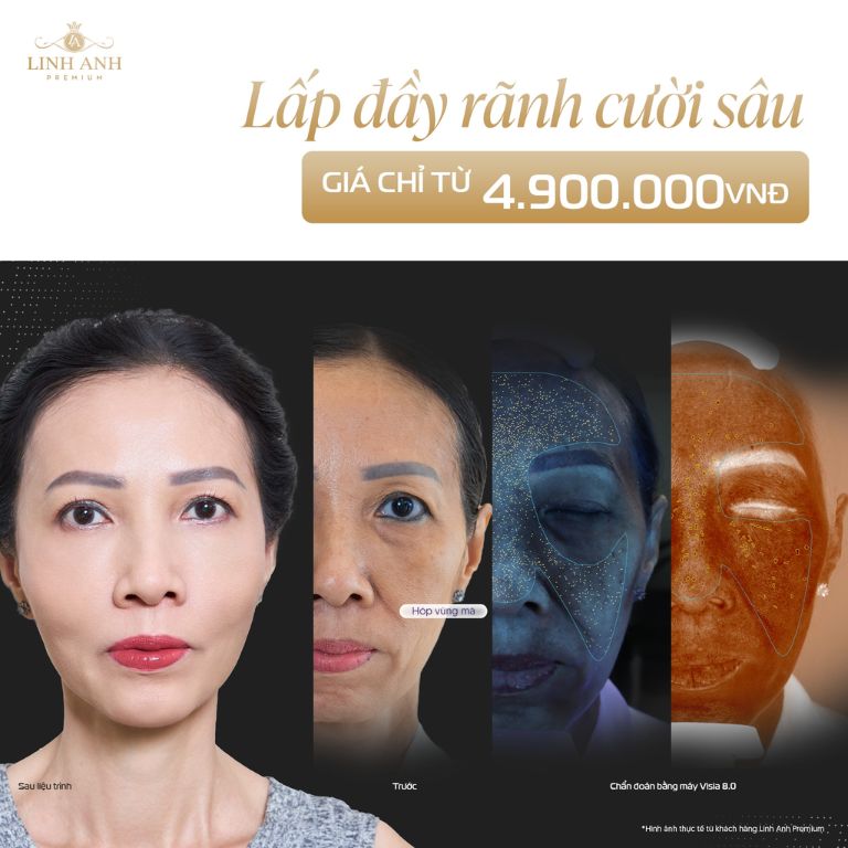 Thẩm mỹ viện quốc tế Linh Anh