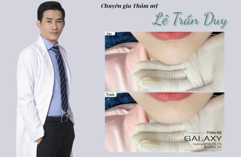 Bác sĩ Lê Trần Duy