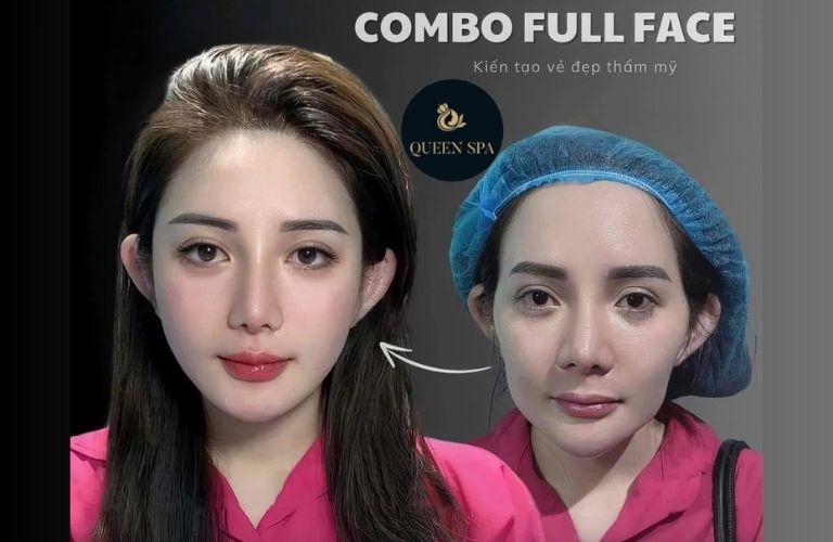 Thẩm Mỹ Queen Spa