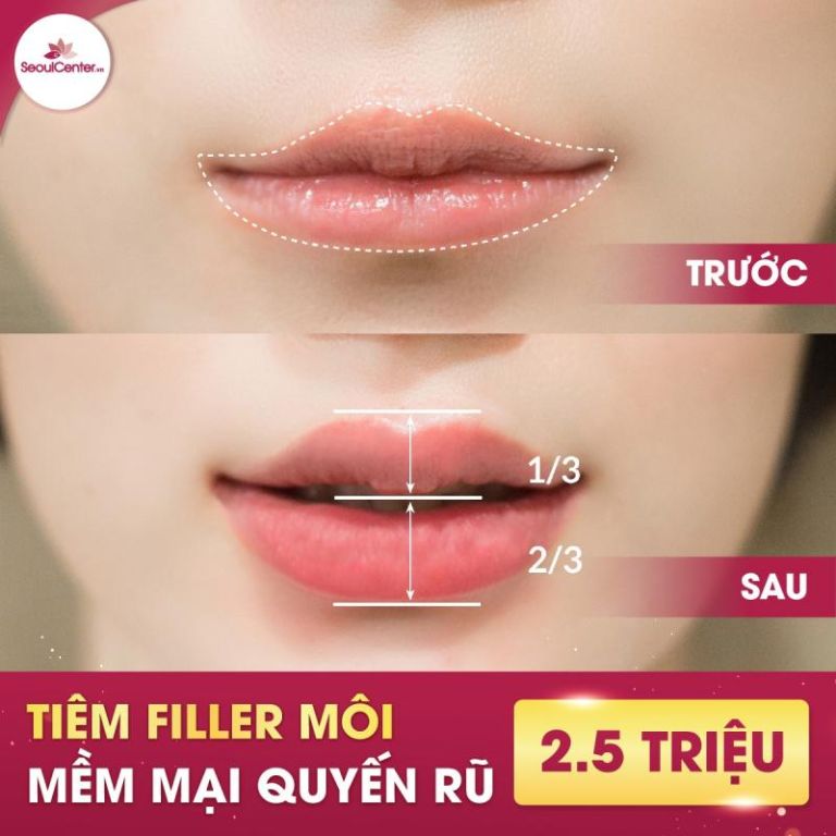 Thẩm mỹ viện Seoul Center