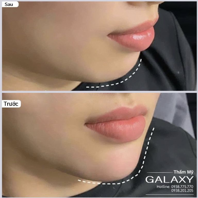 Thẩm mỹ viện Galaxy