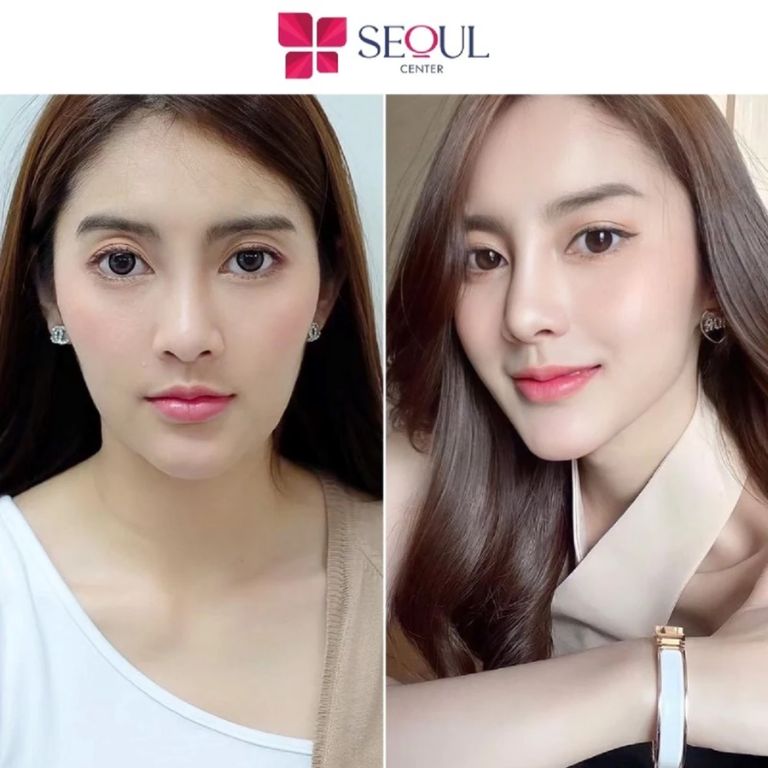 Thẩm mỹ viện Seoul Center