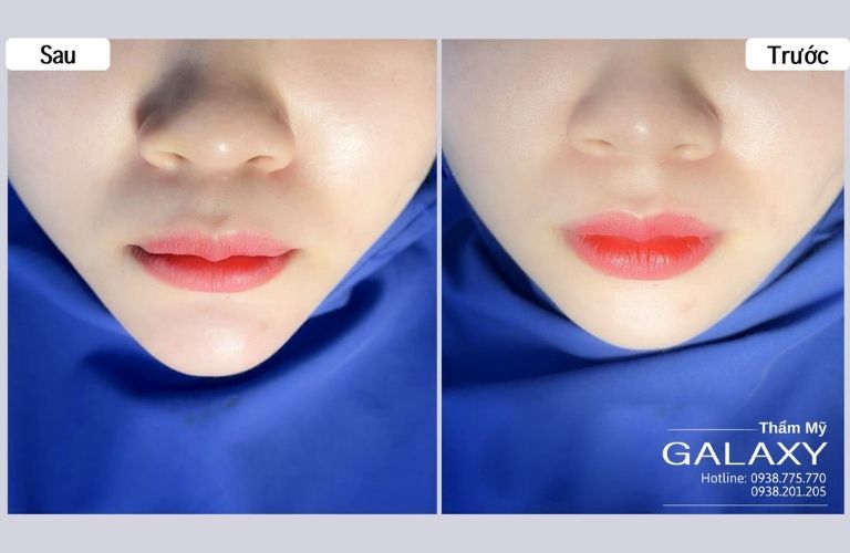 Thẩm mỹ viện Galaxy