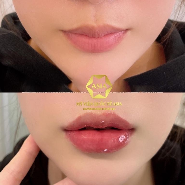 Mỹ viện Quốc tế ASIA