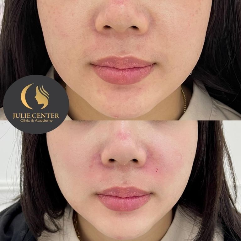 Thẩm mỹ Quốc tế Julie Spa Beauty