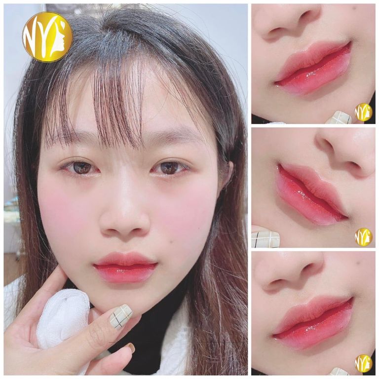 Thẩm mỹ Quốc tế Như Ý