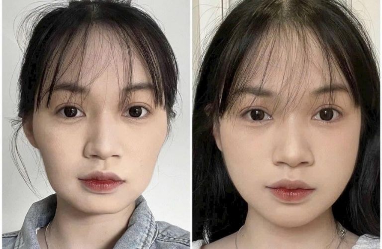 Viện thẩm mỹ Quốc tế VISA