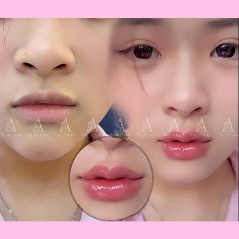 Viện Thẩm Mỹ The An's Beauty