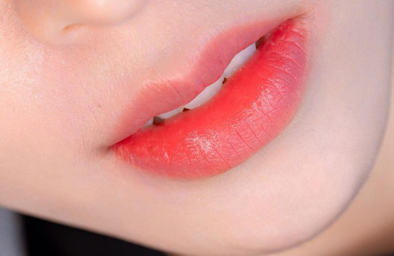 Hiệu quả thẩm mỹ rõ rệt ngay sau khi tiêm