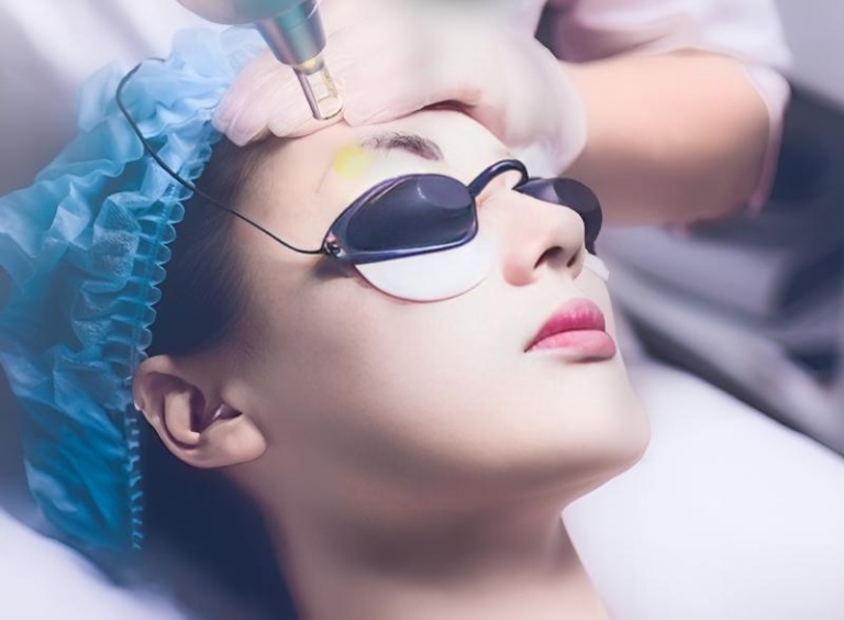 Phương pháp xóa xăm chân mày hiệu quả bằng laser