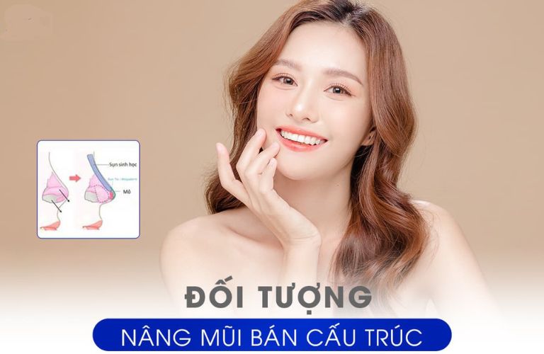 Nâng mũi bán cấu trúc
