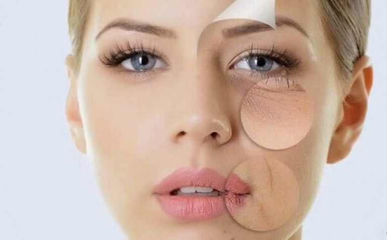 Những ai phù hợp với căng da mặt 3D
