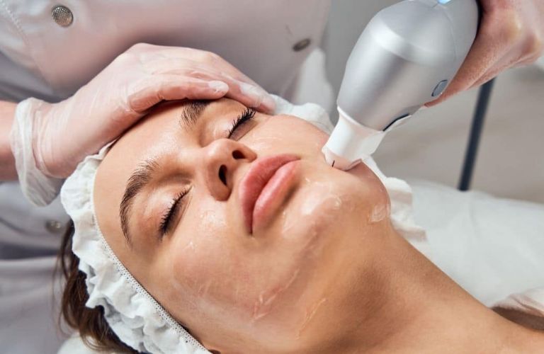 Căng da mặt bán phần bằng công nghệ không xâm lấn