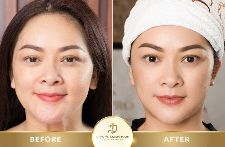Viện Thẩm Mỹ DIVA