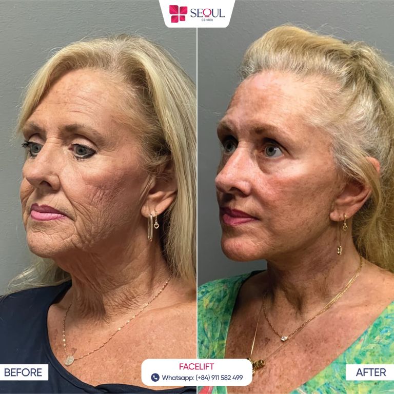 Thẩm mỹ viện Seoul Center