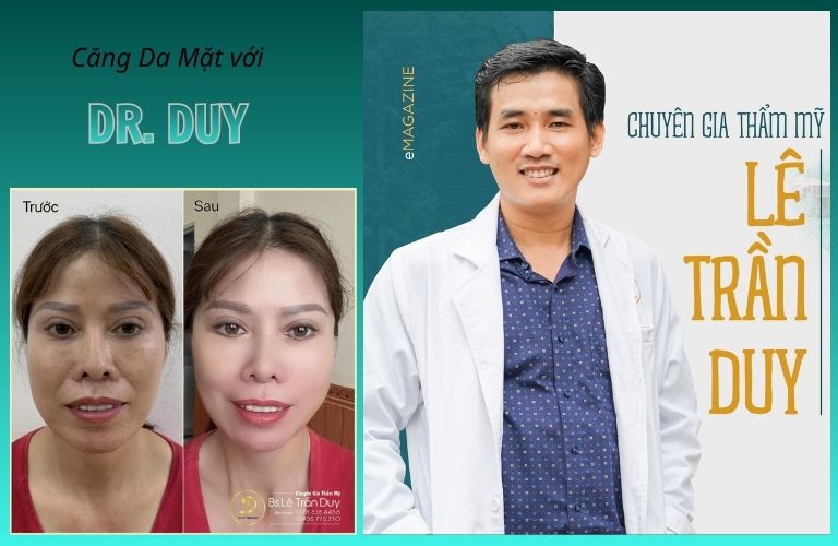 Căng da mặt an toàn, đẹp, hiệu quả dài lâu với chuyên gia Lê Trần Duy tại Thẩm mỹ viện Galaxy