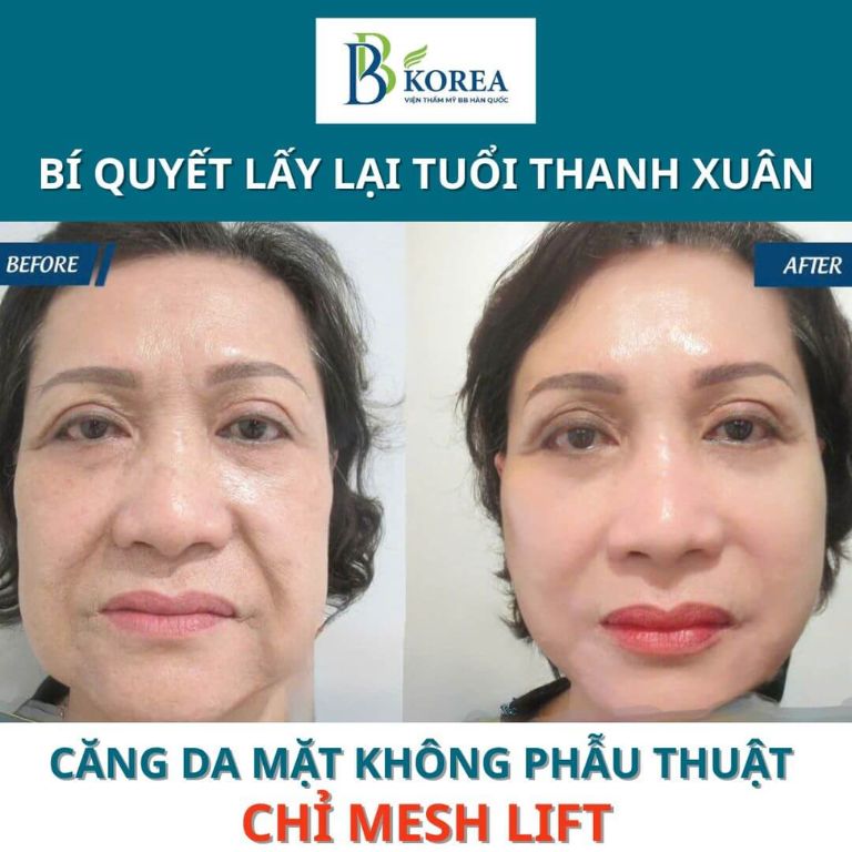 Viện Thẩm Mỹ BB KOREA