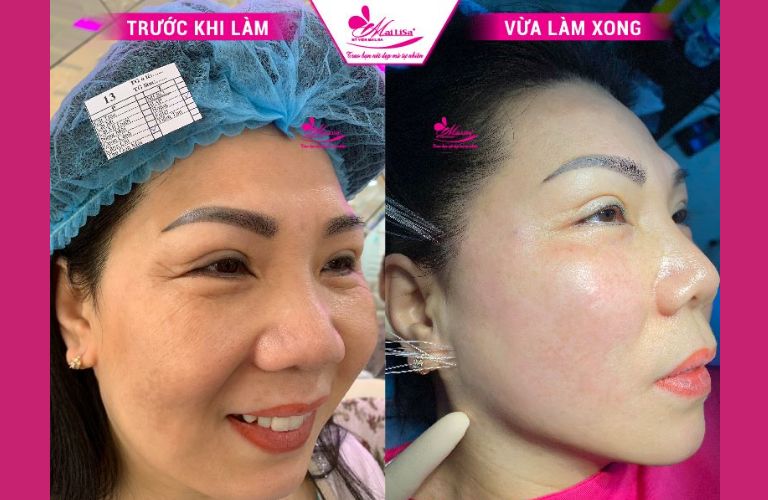 Thẩm mỹ viện Mailisa