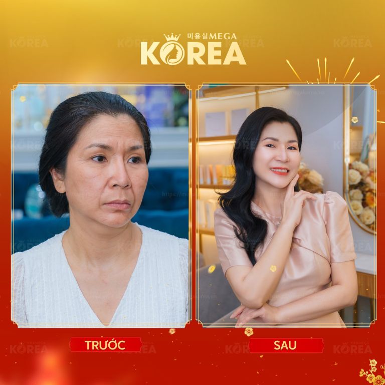 Viện Thẩm Mỹ Mega Korea