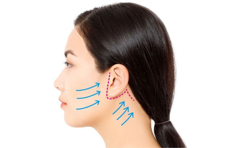 Địa chỉ căng da mặt tại Kon Tum