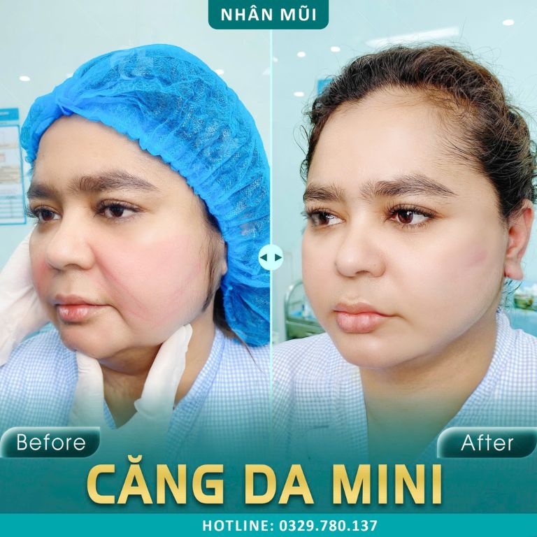 Thẩm mỹ viện Hường Venus