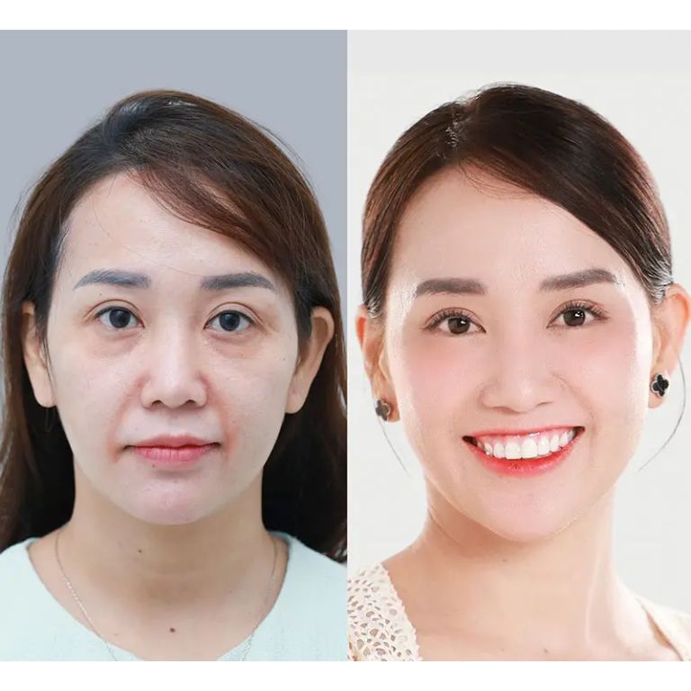 Ưu tiên chọn địa chỉ uy tín, có bác sĩ thực hiện