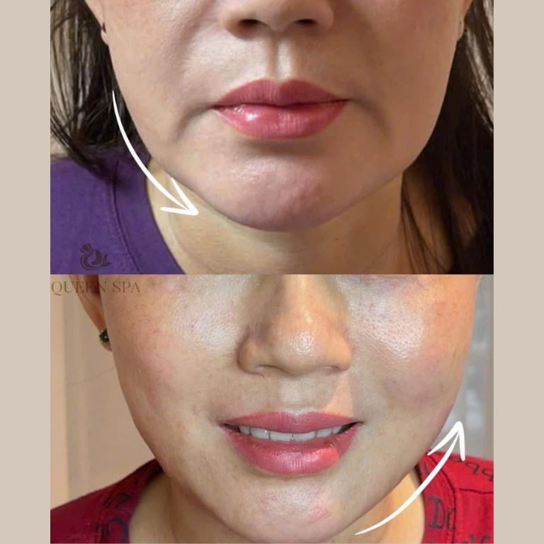 Thẩm Mỹ Queen Spa