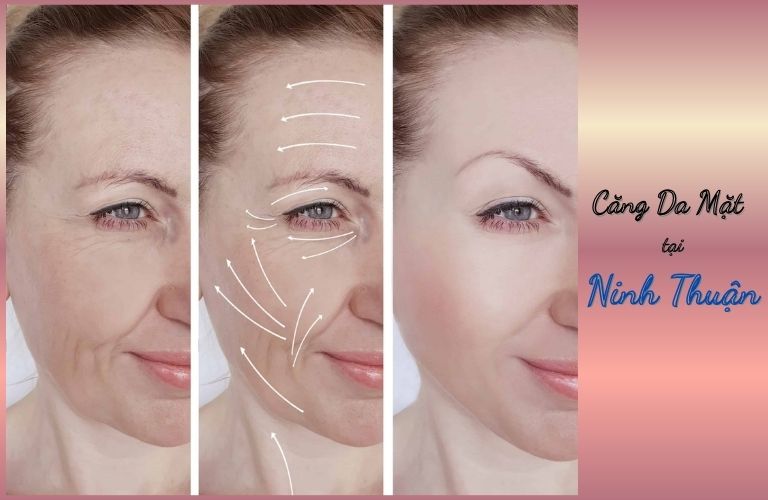  5 Địa chỉ căng da mặt tại Ninh Thuận