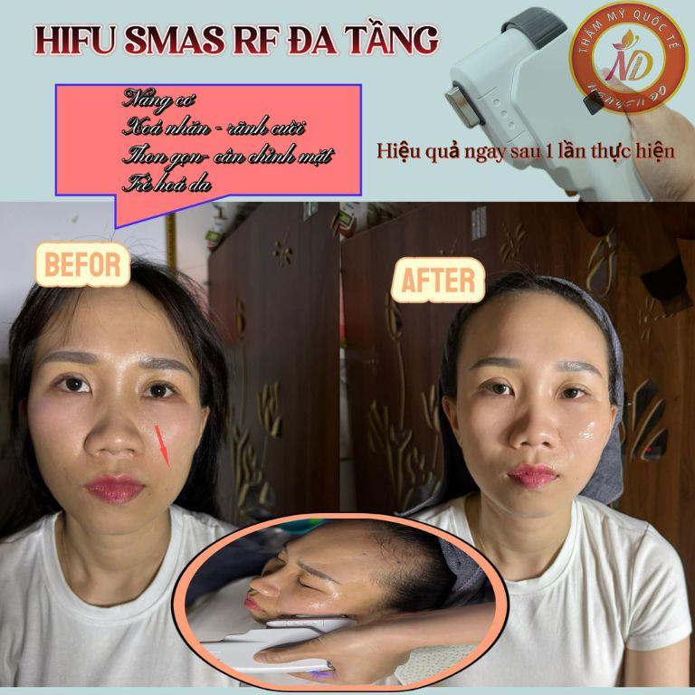 Thẩm mỹ Quốc Tế Nguyên Đô