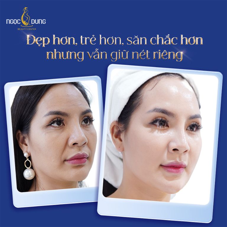 Thẩm mỹ viện Ngọc Dung