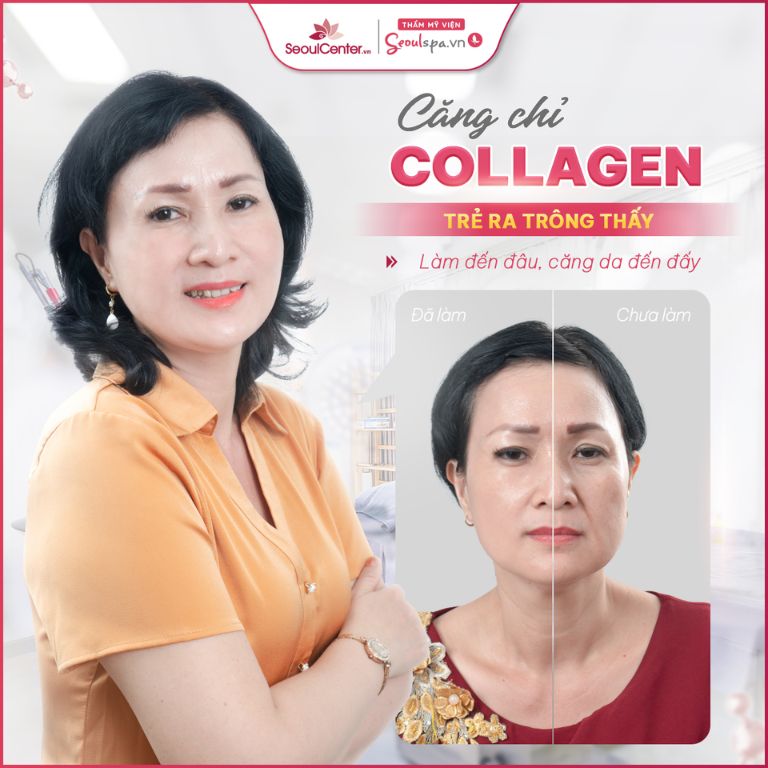 Thẩm Mỹ Viện Seoul Center