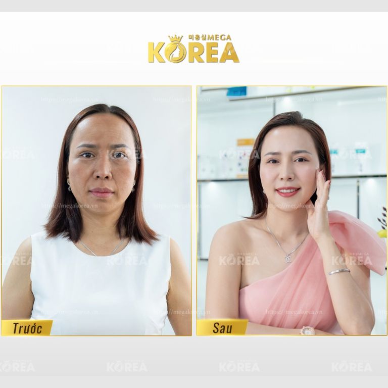 Viện Thẩm Mỹ Mega Korea