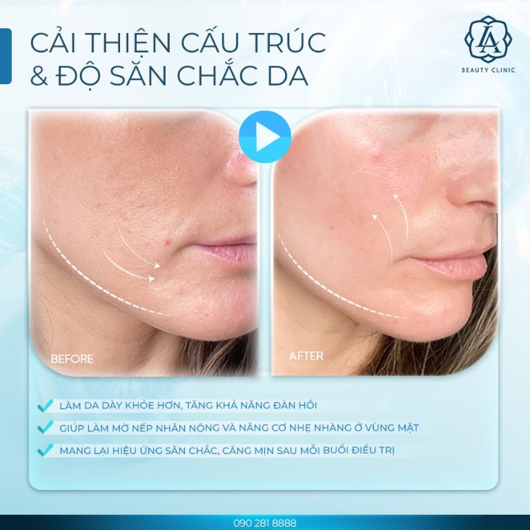 Viện thẩm mỹ LA Beauty Clinic