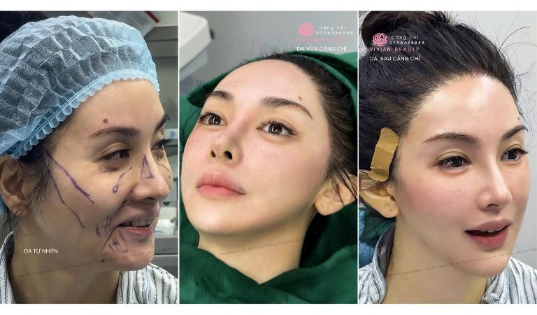 Viện Thẩm Mỹ Vivian Beauty