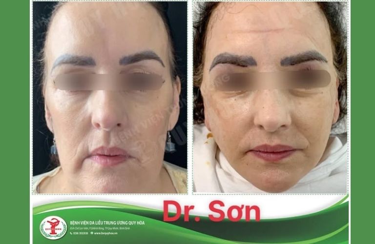 Thẩm mỹ viện Dr. Sơn