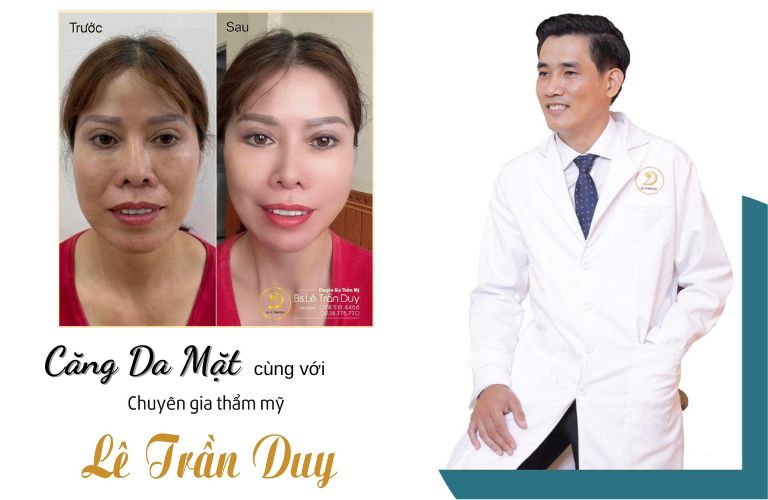 Dịch vụ căng da mặt do chính bác sĩ Lê Trần Duy thực hiện