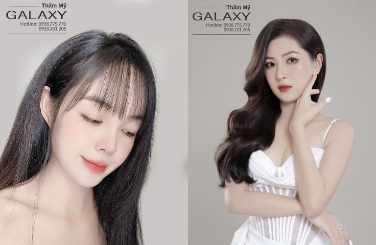 Thẩm mỹ viện Galaxy - BS Lê Trần Duy